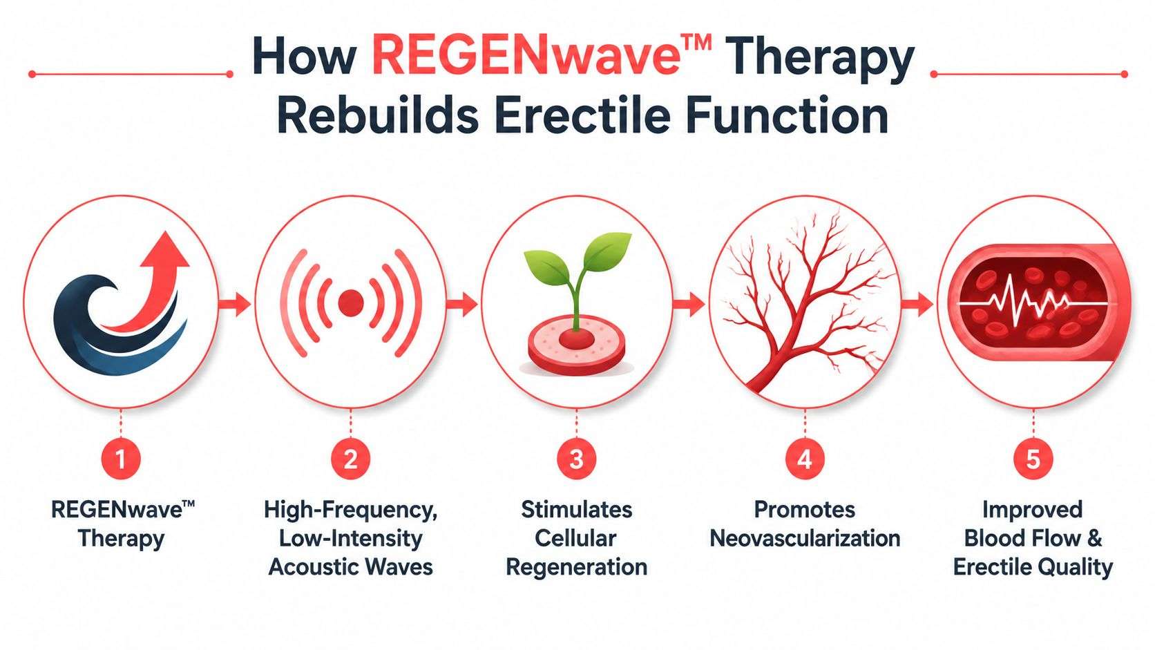An infographic showing the five steps of REGENwave therapy to improve erectile function through acoustic wave technology.